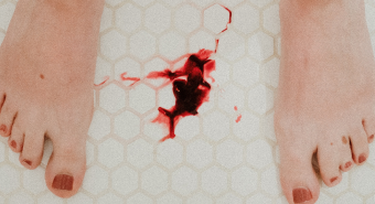 Action image